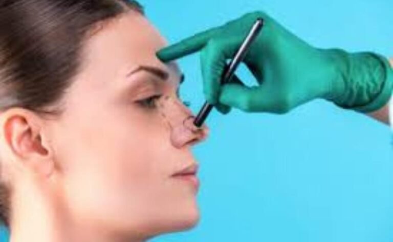 Rinoseptoplastia: quando respirar melhor é também um gesto de amor-próprio