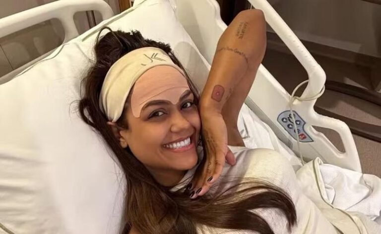 Camila Loures remove veia da testa com técnica moderna a laser na JK Estética Avançada