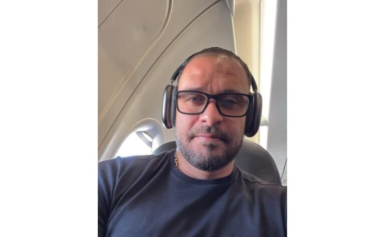 Transplante capilar ganha força entre famosos e impulsiona busca pelo procedimento