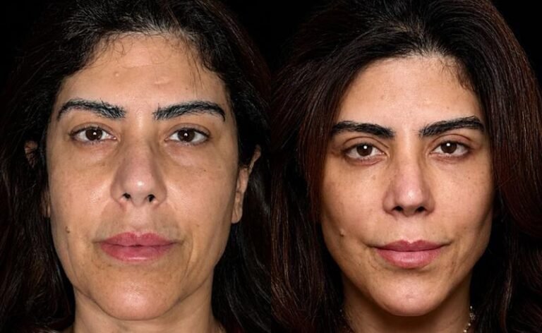 Dr. Thallys Santana e Elaine Cristina unem autoestima, imagem e reconstrução pessoal em transformação estética marcada por naturalidade