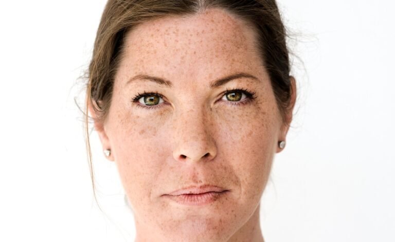 Melasma: a ciência mostra que as manchas podem começar de dentro para fora